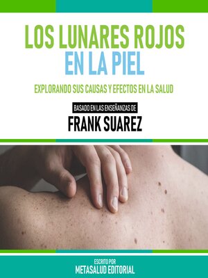 cover image of Los Lunares Rojos En La Piel--Basado En Las Enseñanzas De Frank Suarez